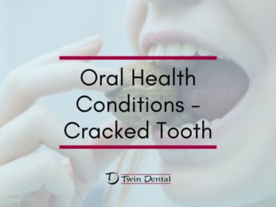 Oral-Health-Conditions-Cracked-Tooth-820x420