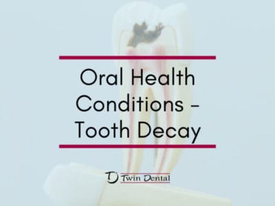 Oral-Health-Conditions-Tooth-Decay-820x420