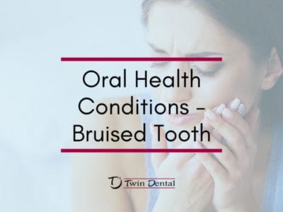 Oral-Health-Conditions-Bruised-Tooth-820x420