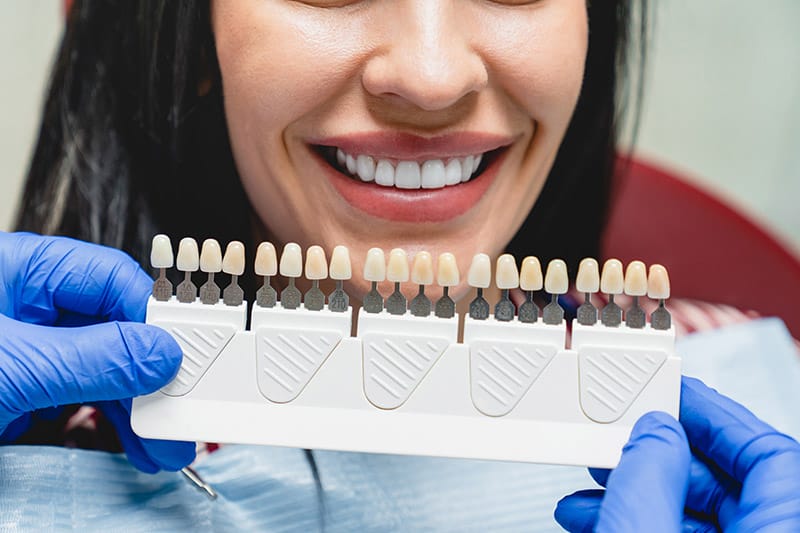 Transform Your Smile: Discover Cosmetic Dentistry Veneers!