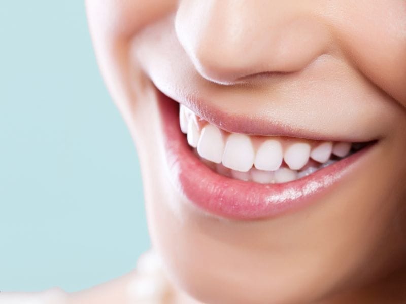 Brighter Smiles: Cosmetic Teeth Whitening for a Radiant Look!